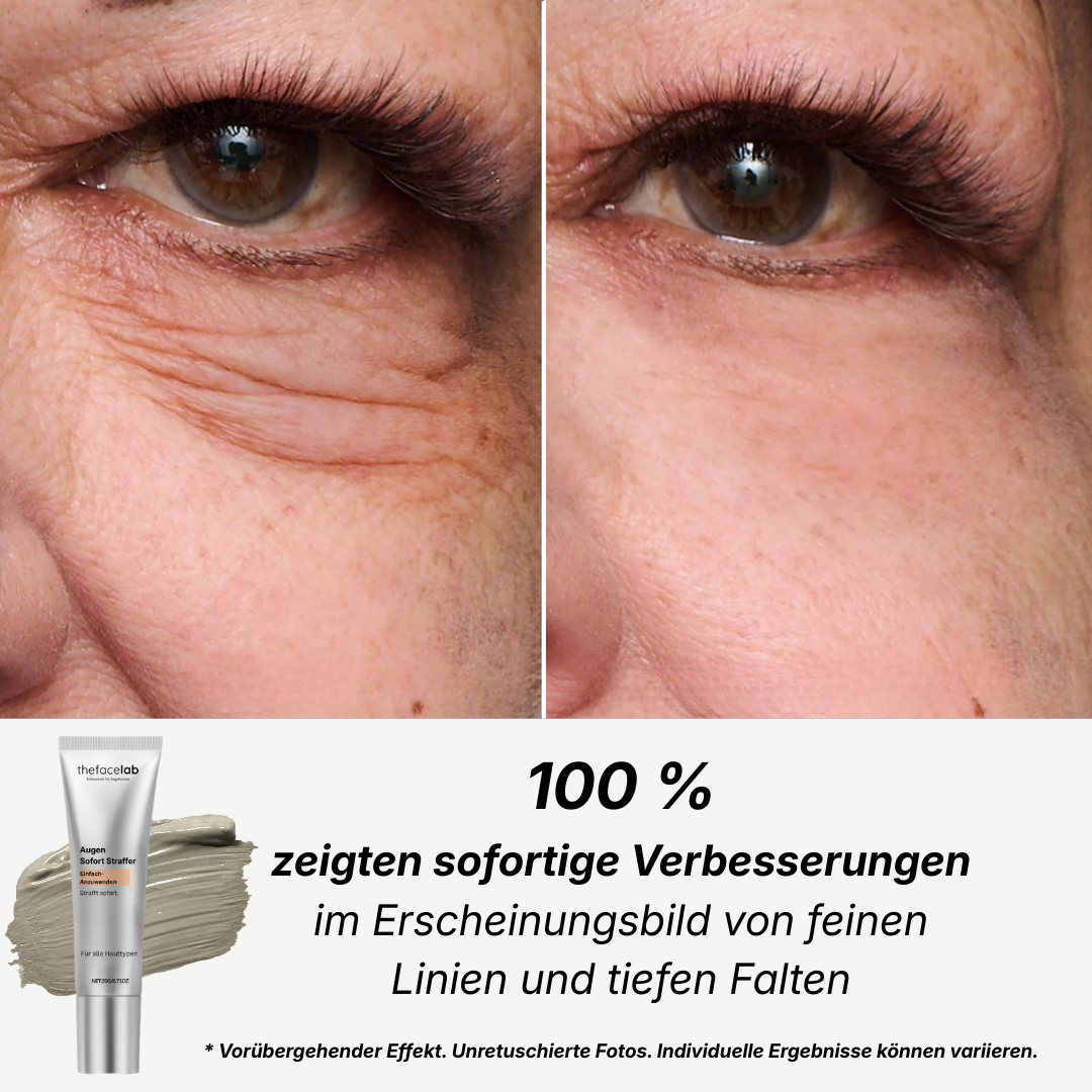 TheFaceLab - Augen Sofort Straffer