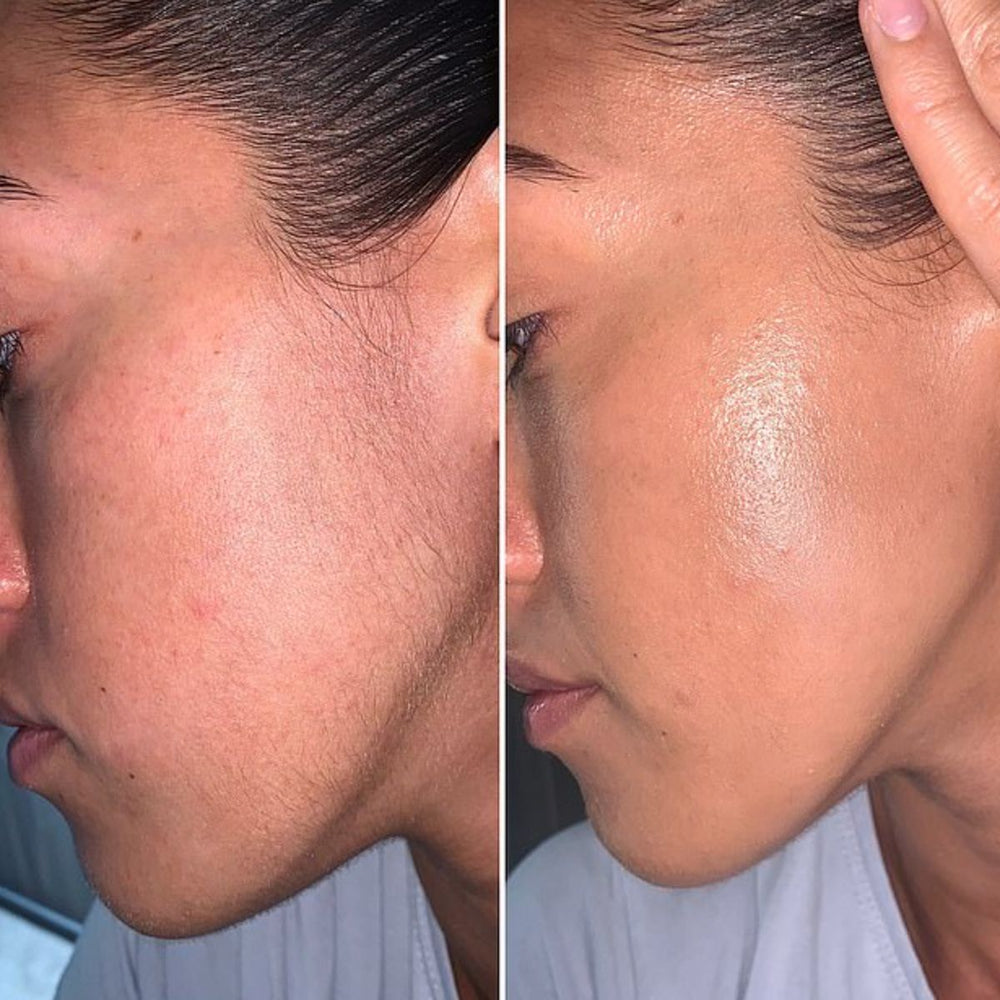 <h1><strong>Sichtbar reduziertes Haarwachstum in 30 Tagen</strong></h1>