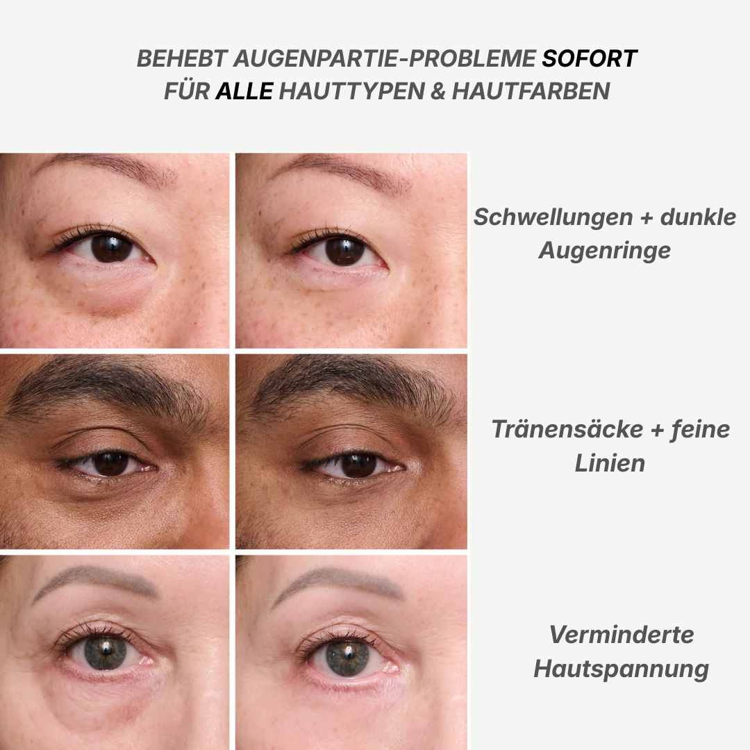TheFaceLab - Augen Sofort Straffer