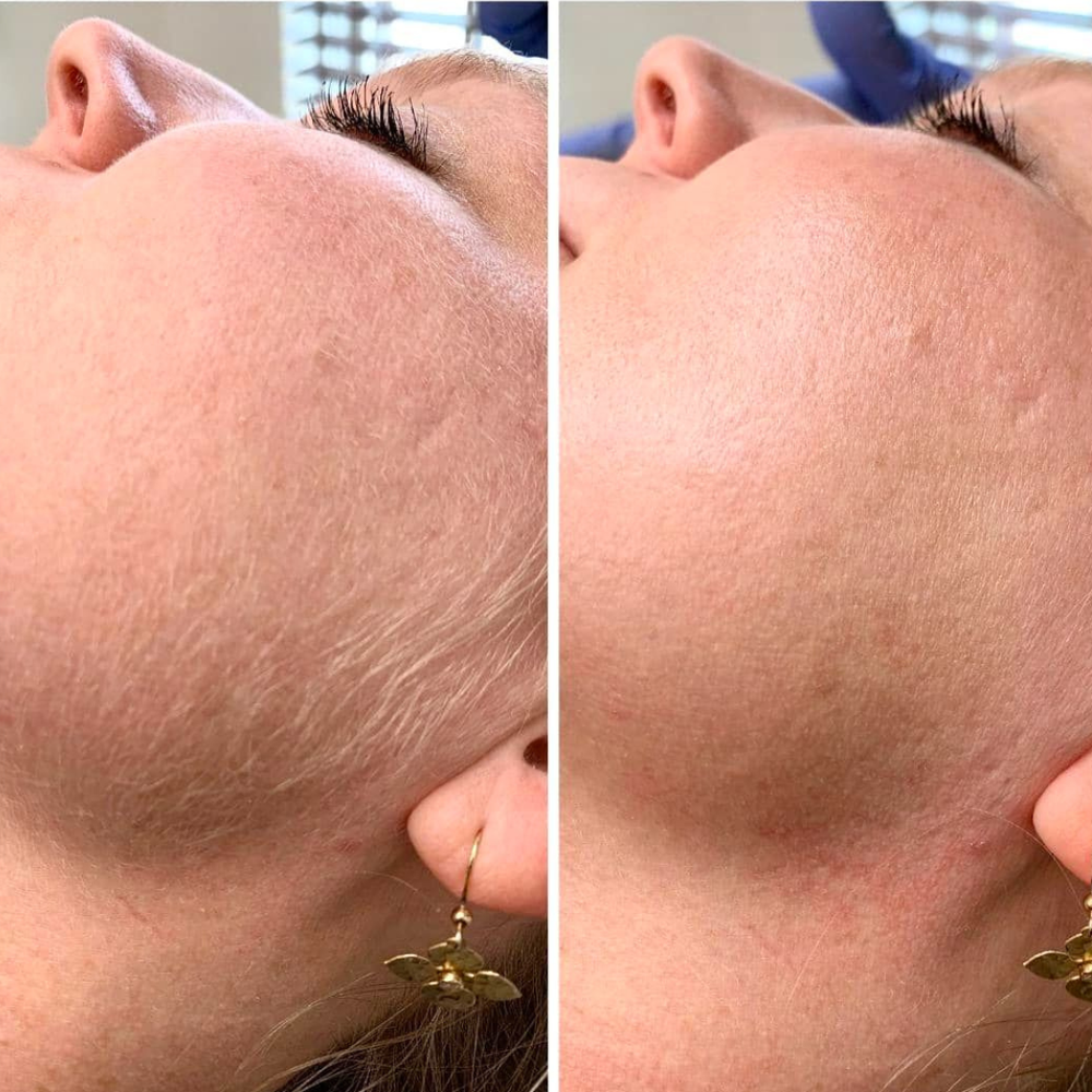 <h1><strong>Sichtbar reduziertes Haarwachstum in 30 Tagen</strong></h1>